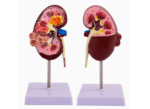 腎臟病變模型